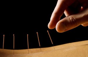Acupuncture-in-Brisbane